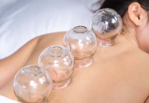 60-Minute Acupuncture Treatment for One Person - Option for ACC-Injury Treatment, Acupuncture & Cupping — photo 3