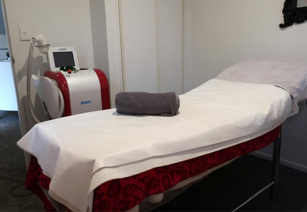 Microdermabrasion Facial - Option to incl. a Soothing Mask & Eyebrow Shape — photo 4