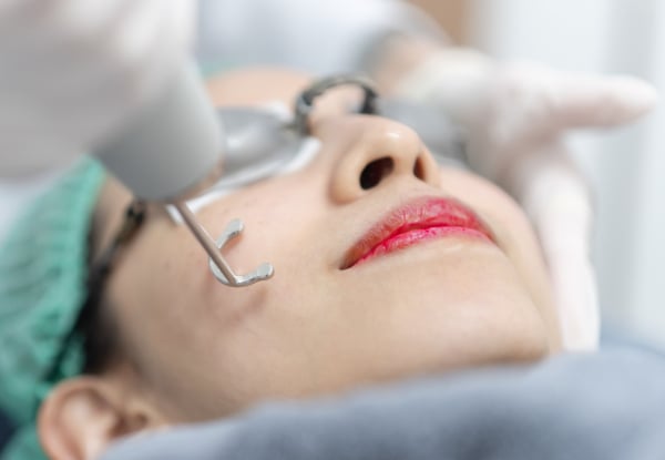 One Session of Advanced Pico Laser Rejuvenation Treatment - Option for Three Sessions