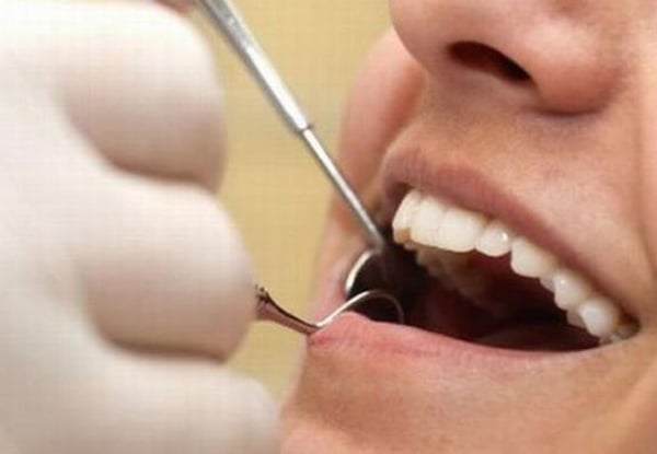 City Centre Dental Package incl. Dental Exam, Clean & Polish — photo 3