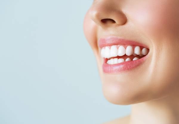 Teeth Whitening at Phoebe's Beauty Parlour - Option for Glam White Treatment or Hollywood White Treatment — photo 2