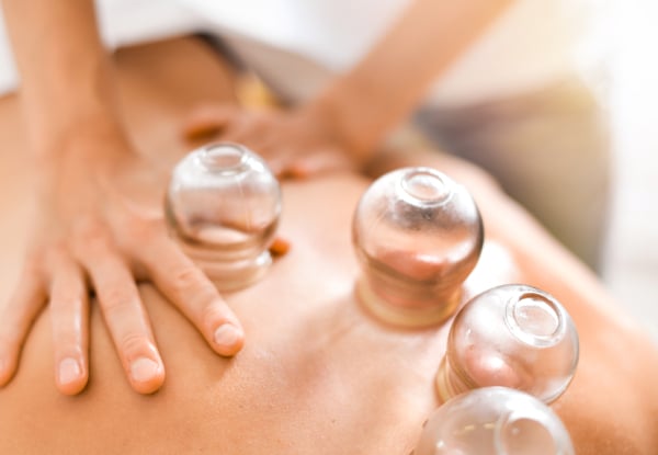 60-Minute Acupuncture Treatment - Option for ACC Injury Treatment, Acupuncture & Cupping, Acupuncture & Massage and Acupuncture Treatment — photo 3