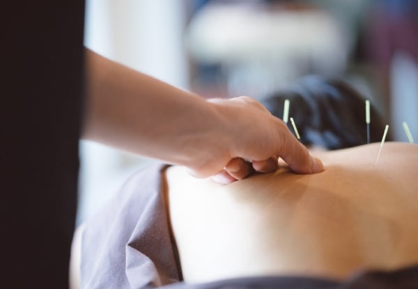 60-Minute Acupuncture Session for One Person — photo 3