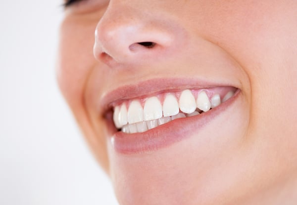 One-Hour Dental Hygienist Appointment incl. Scale & Clean — photo 3