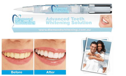Diamond Whitening