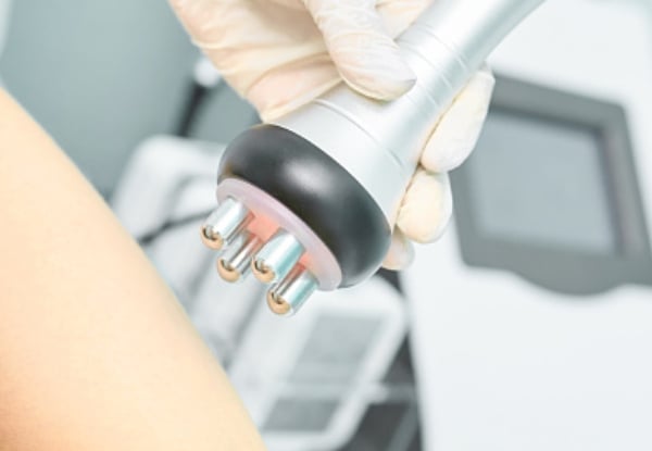 Cavi Lipo Fat Treatment Session for One Person - Option for Two or Five Sessions — photo 5