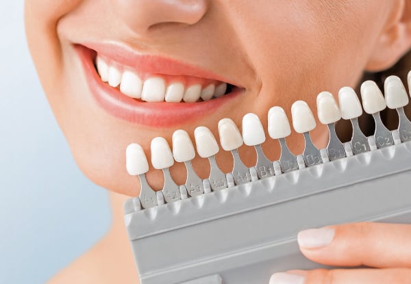 60-Minute Teeth Whitening LED Light Treatment — photo 3